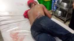 Tak Diberi Pinjam Becak, Sekelompok Pemuda Bacok Penjaga Malam