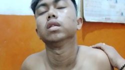 Remaja di Mandala Jadi Korban Salah Sasaran Aksi Tawuran, Paha dan Punggung Dibacok